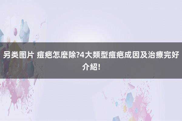 另类图片 痘疤怎麼除?4大類型痘疤成因及治療完好介紹!